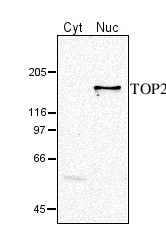 TOP2 | DNA topoisomerase II in the group Antibodies Plant/Algal  / DNA/RNA/Cell Cycle / Transcription regulation at Agrisera AB (Antibodies for research) (AS05 096)